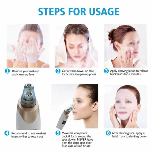 Electric Blackhead Remover Vacuum | USB Rechargeable Pore Cleaner with 5 Suction Heads