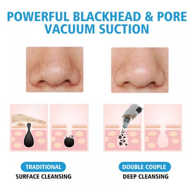 Electric Blackhead Remover Vacuum USB Rechargeable Pore Cleaner with 5 Suction Heads