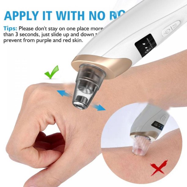 Electric Blackhead Remover Vacuum USB Rechargeable Pore Cleaner with 5 Suction Heads