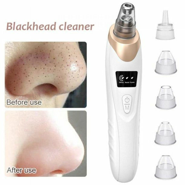 Electric Blackhead Remover Vacuum | USB Rechargeable Pore Cleaner with 5 Suction Heads